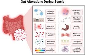 Gut bacteria may help explain why sepsis hits some patients harder