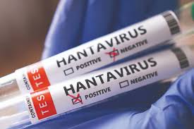 Why officials say hantavirus is not another COVID-19
